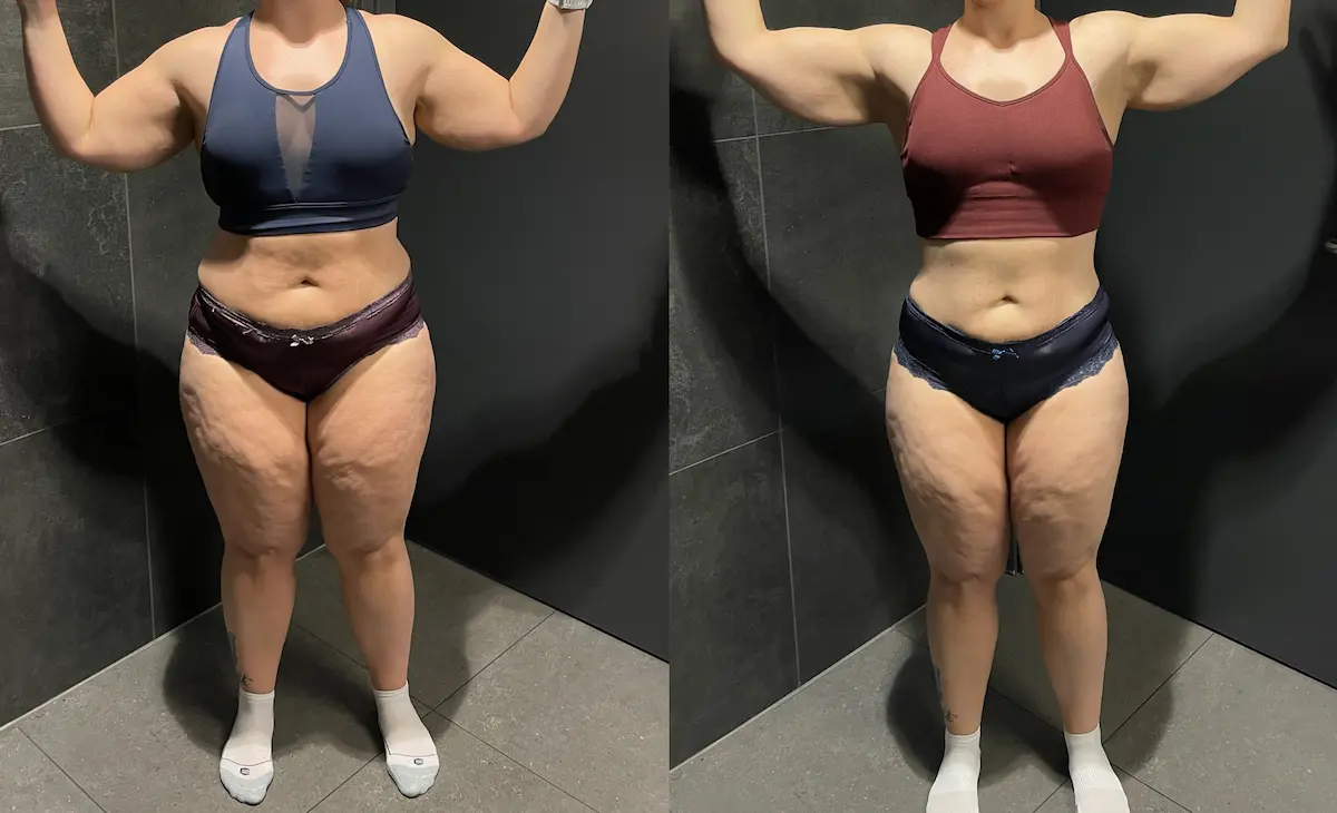 klient transformation 1